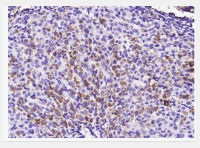 Anti-ALOX15B antibody-花生四烯酸15脂氧合酶2抗体