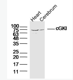 Anti-cGKI antibody-cGMP依赖性蛋白激酶1抗体