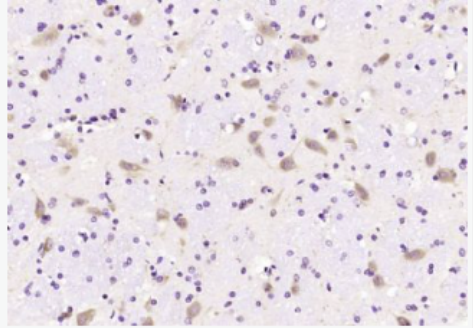 Anti-NALP12  antibody-NALP12抗体