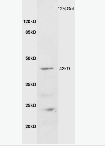 Anti-GALR2 antibody-甘丙肽受体2抗体