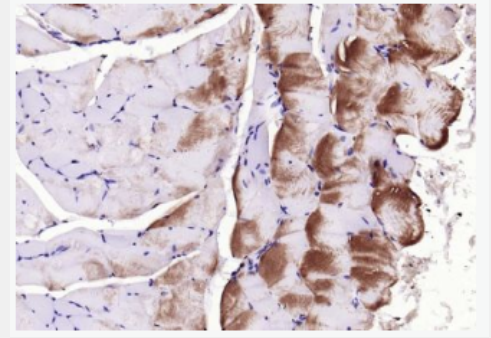 Anti-CACNA1S antibody-电压依赖性钙通道Cav1.1抗体