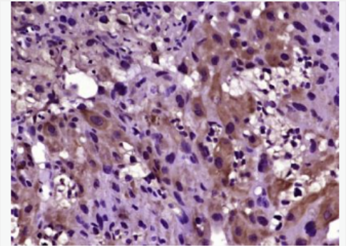 Anti-Laminin 2 alpha antibody-层粘蛋白α2抗体