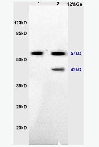 Anti-IRX4 antibody-Iroquois同源蛋白4抗体