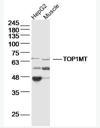 Anti-TOP1MTantibody-线粒体DNA拓普西异构酶Ⅰ抗体