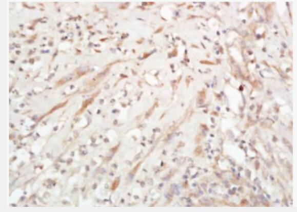 Anti-Jagged1antibody-CD339抗体