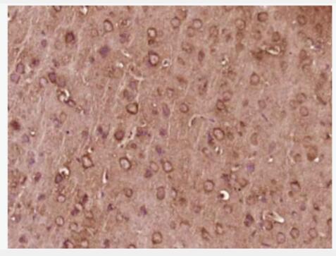 Anti-G-CSF/CSF3 antibody-粒细胞-巨噬细胞集落刺激因子3抗体