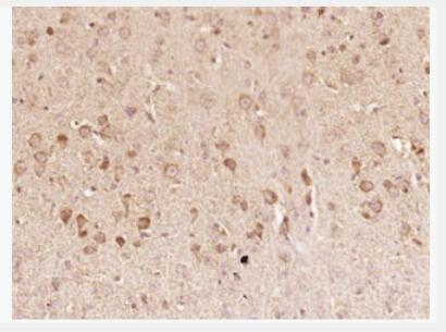 Anti-RANTES antibody-CT细胞特异性趋化因子抗体