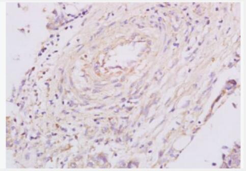 Anti-Granulin   antibody-颗粒蛋白前体抗体