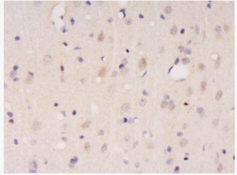 Anti-CDKN2A/p19ARF   antibody-抑癌基因p19抗体