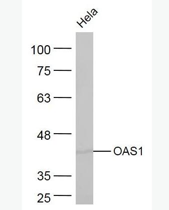 Anti-OAS1   antibody-寡腺苷酸合成酶-1抗体