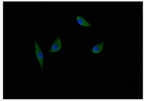 Anti-NGFB antibody-神经生长因子β抗体