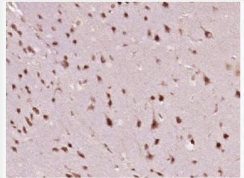 Anti-Nm23-H2/NME2 antibody-肿瘤抑制基因NME2抗体