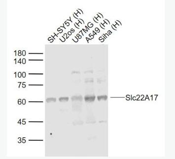Anti-Slc22A17 antibody-可溶性载质转运蛋白22A17抗体