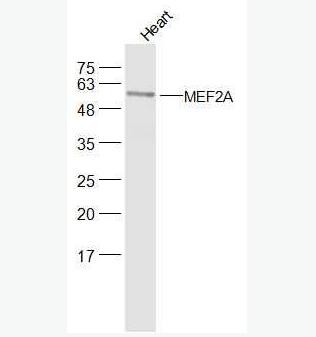 Anti-DMEF2A  antibody-肌细胞增强因子2抗体
