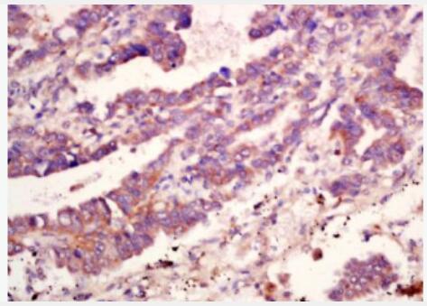 Anti-MMP10 antibody-基质金属蛋白酶-10抗体