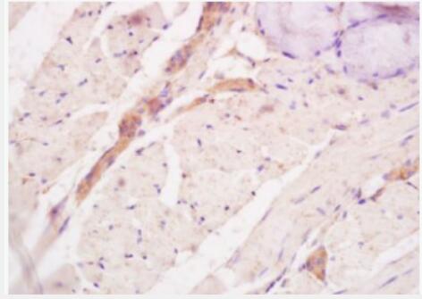 Anti-Tenascin C  antibody-细胞粘合素/腱糖蛋白-C/固生蛋白抗体
