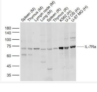 Anti-IL7R antibody-白细胞介素-7受体a（CD127）抗体