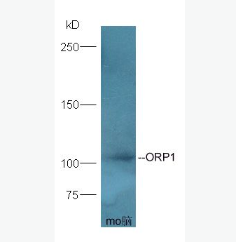 Anti-ORP1 antibody-氧固醇结合蛋白样1A抗体