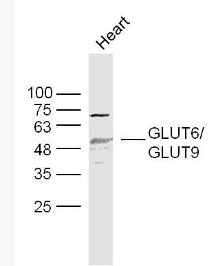 Anti-GLUT6 antibody-葡萄糖转运蛋白6抗体