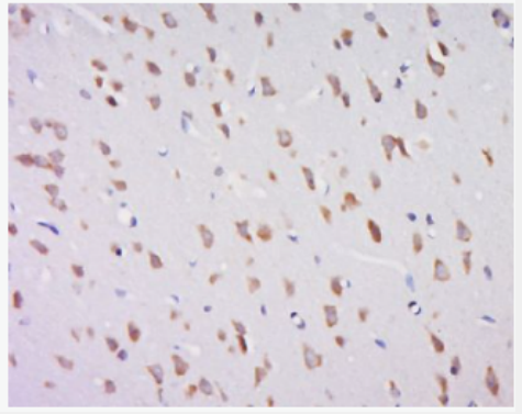 Anti-Galactosylceramidase  antibody-半乳糖神经酰胺酶抗体