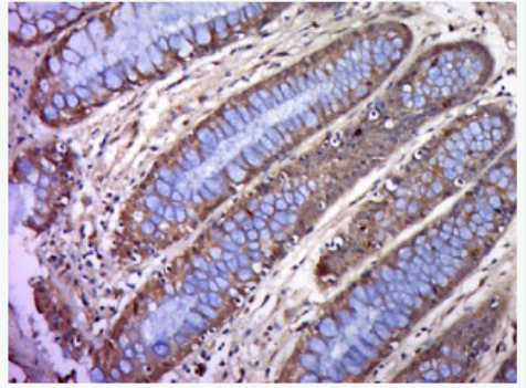 Anti-BTN2A1 antibody-嗜乳脂蛋白2亚型A1抗体