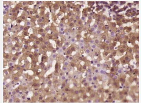 Anti-StAR antibody-促黄体激素诱导蛋白抗体
