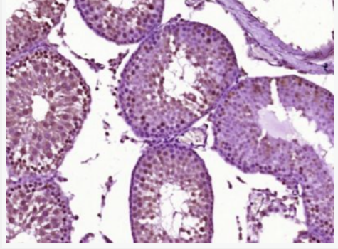 Anti-AR/Androgen receptor  antibody-雄激素受体（AR）抗体