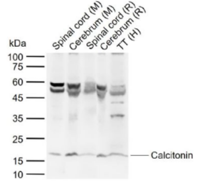Anti-Calcitonin antibody-降钙素抗体
