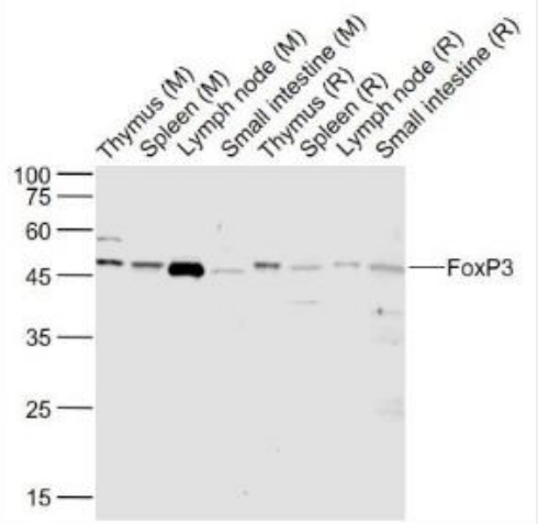 Anti-UFOXP3 antibody-叉头蛋白P3抗体