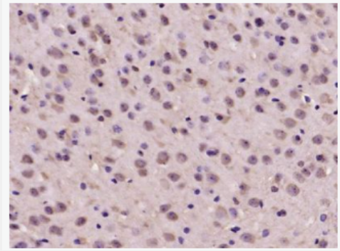 Anti-ADNP antibody-活性依赖的神经保护肽抗体