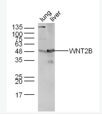 Anti-WNT2B antibody-信号通路Wnt2B抗体