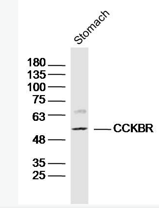 Anti-CCKBR antibody-促胃泌素受体抗体