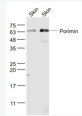 Anti-Porimin antibody-前细胞胀亡受体诱导膜损伤蛋白抗体