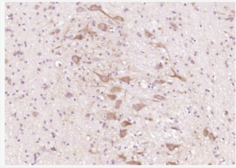 Anti-CTNND2/delta 2 Catenin antibody-δ-连环蛋白抗体