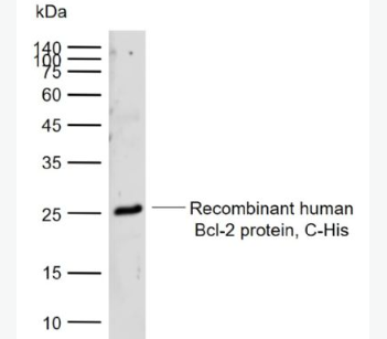 Anti-Bcl-2 alpha antibody-Bcl2 alpha蛋白抗体