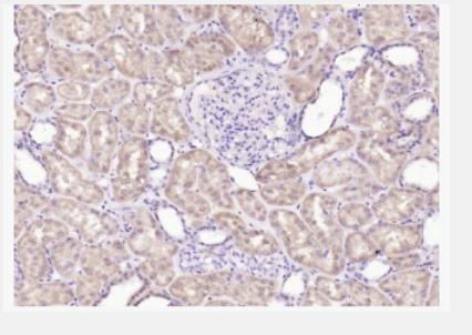 Anti-DIP2B antibody-DIP2B蛋白抗体