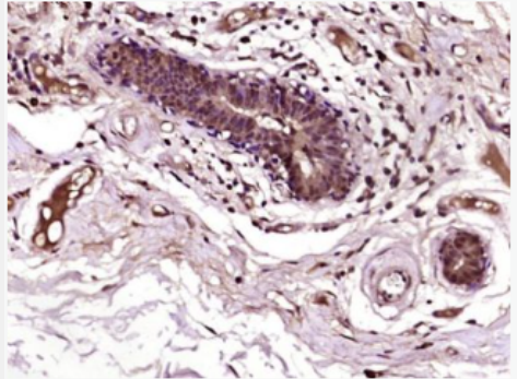 Anti-RAF1 antibody-癌基因RAF1抗体