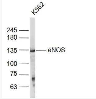 Anti-eNOS  antibody-一氧化氮合成酶-3（内皮型）抗体