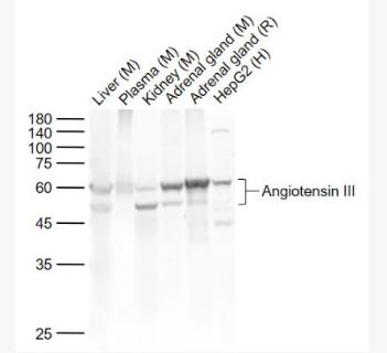 Anti-Angiotensin III antibody-血管紧张素III抗体