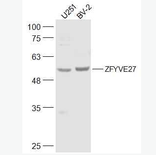 Anti-ZFYVE27 antibody-锌指FYVE结构域蛋白27抗体