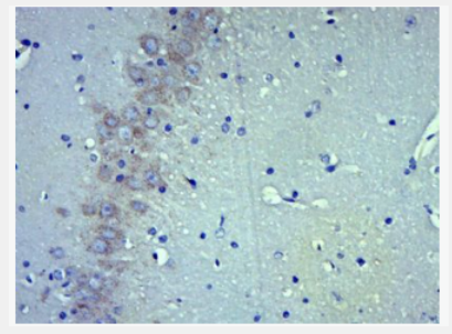 Anti-Somatostatin 28 antibody-生长抑素抗体