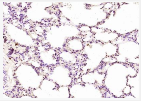 Anti-NR0B2 antibody-核受体0相关蛋白B家族2抗体