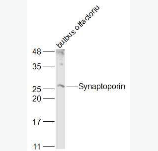 Anti-SYNPR/Synaptoporin antibody-突触囊泡蛋白抗体