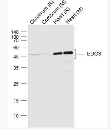 Anti-EDG3 antibody-内皮分化型G蛋白偶联受体3抗体