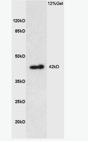 Anti-Prostaglandin E Receptor EP1 antibody-前列腺素EP1受体抗体