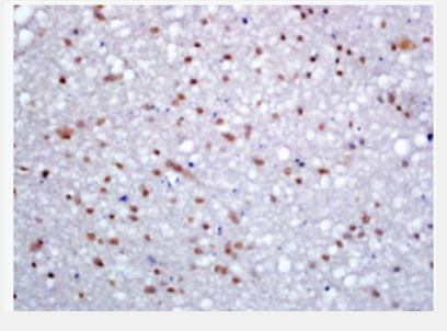 Anti-KDM5B antibody-赖氨酸特异性去甲基酶5B 抗体