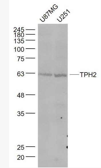 Anti-TPH2 antibody-5色氨酸羟化酶2抗体