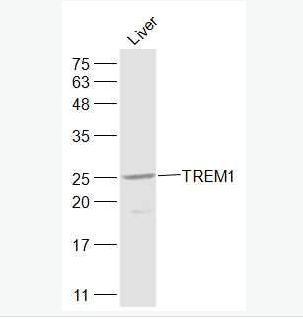 Anti-TREM1 antibody-髓系细胞触发受体1抗体