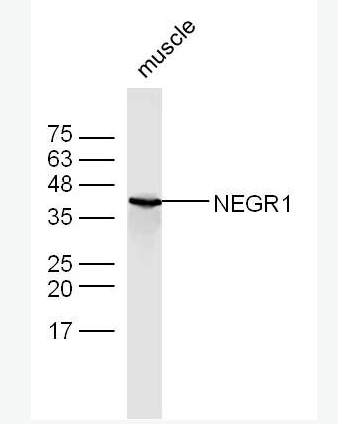 Anti-NEGR1 antibody-神经生长调节蛋白1抗体