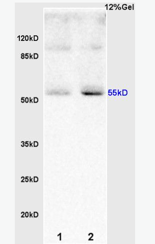 Anti-RBPJK  antibody-Notch转录调控蛋白RBPJK抗体